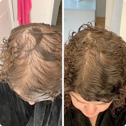 <img src="https://alikanature.com/wp-content/uploads/2025/04/hair-bond-spray-author-1.webp"><br>Alexandra V.